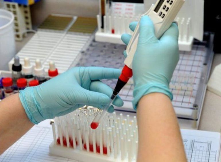 протромбированный индекс