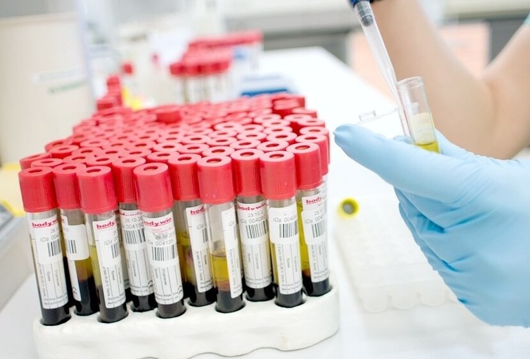 Пса анализ крови и его расшифровка