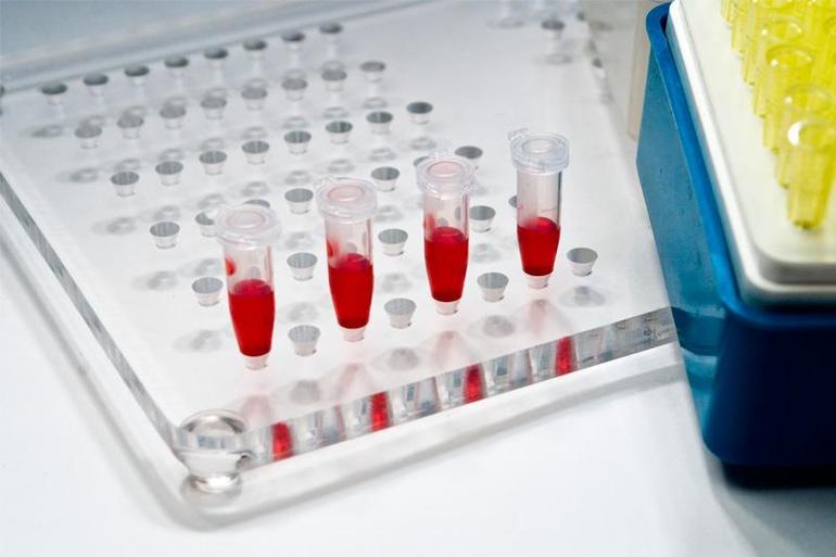 расшифровка анализа крови на сахар