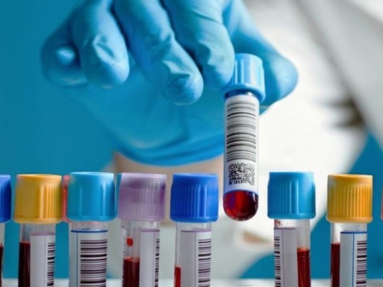 Расшифровка торч