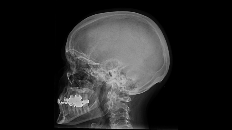 Рентген головы