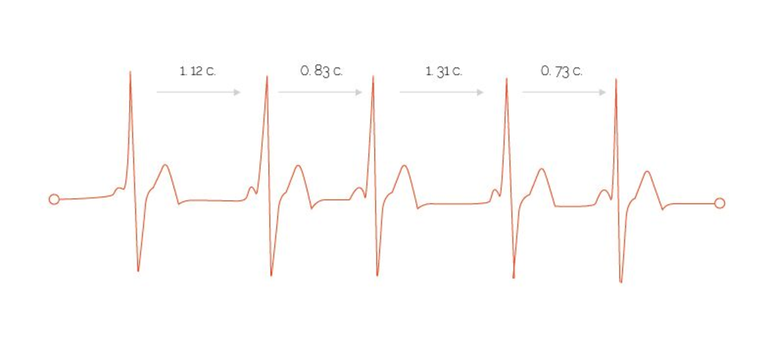 Ритмичное сокращение сердечной мышцы