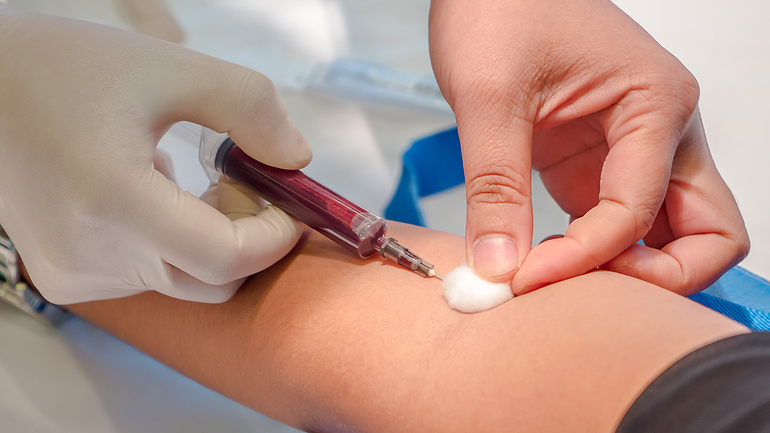 са 125 расшифровка онкомаркер