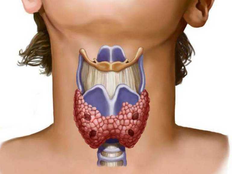 Щитовидная железа