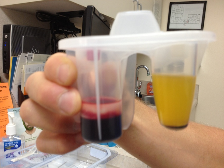 Сдача анализов