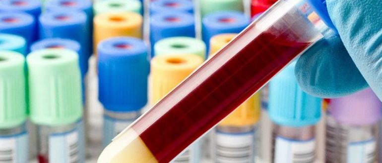 Сдача крови на сахар