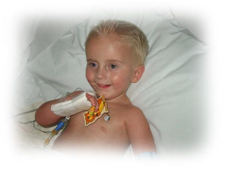 Семейная форма ДКП — синдром Барта,