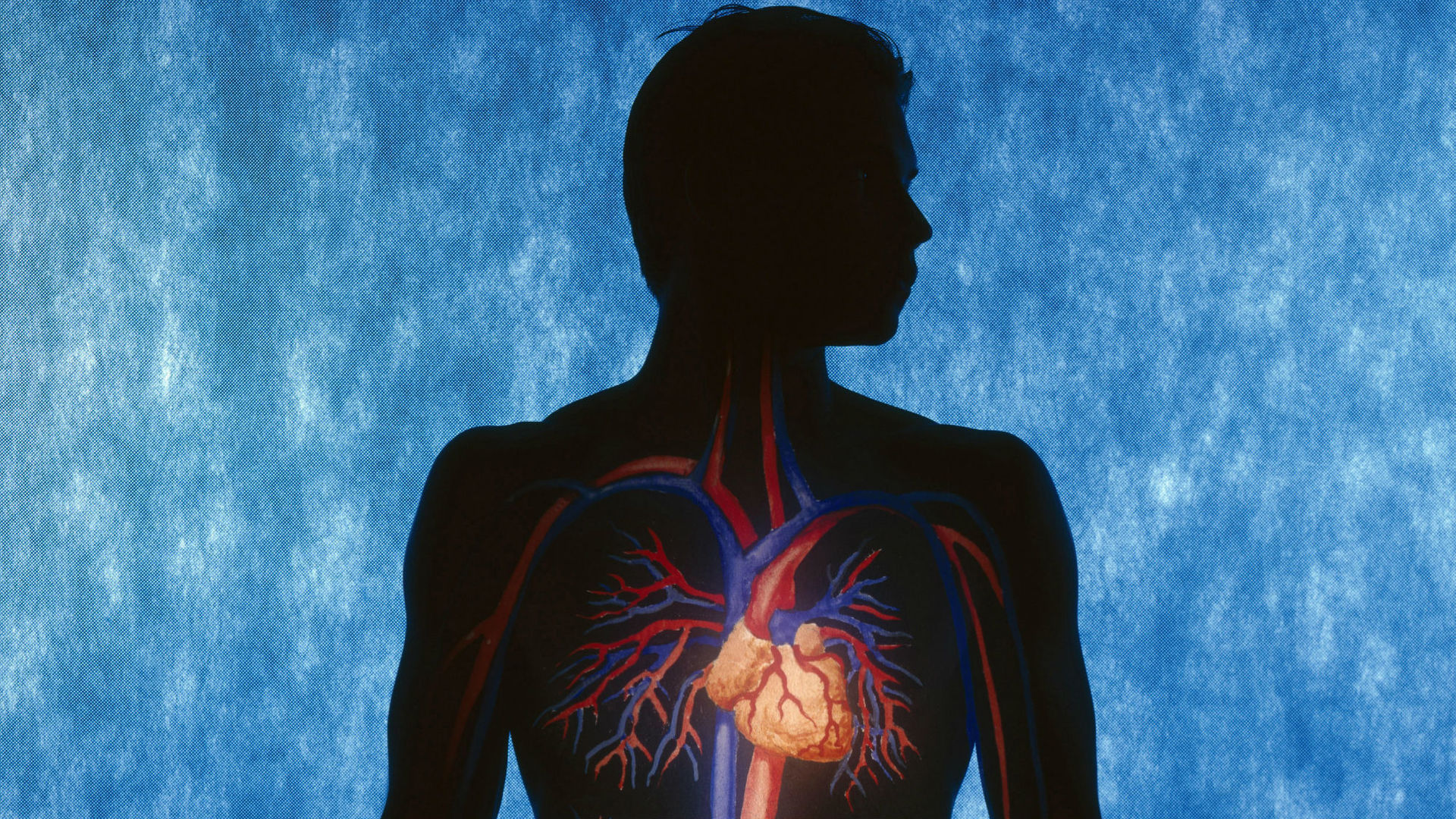 сердечная мышца