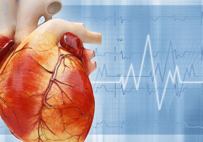 Сердечная аномалия