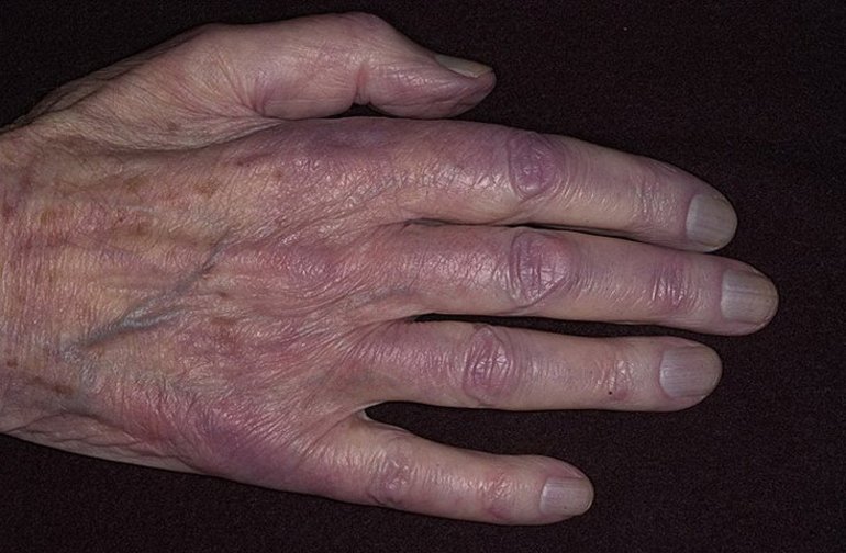 Сердечная патология