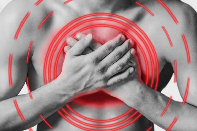 Сердечно сосудистая недостаточность