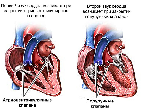 шумы в сердце