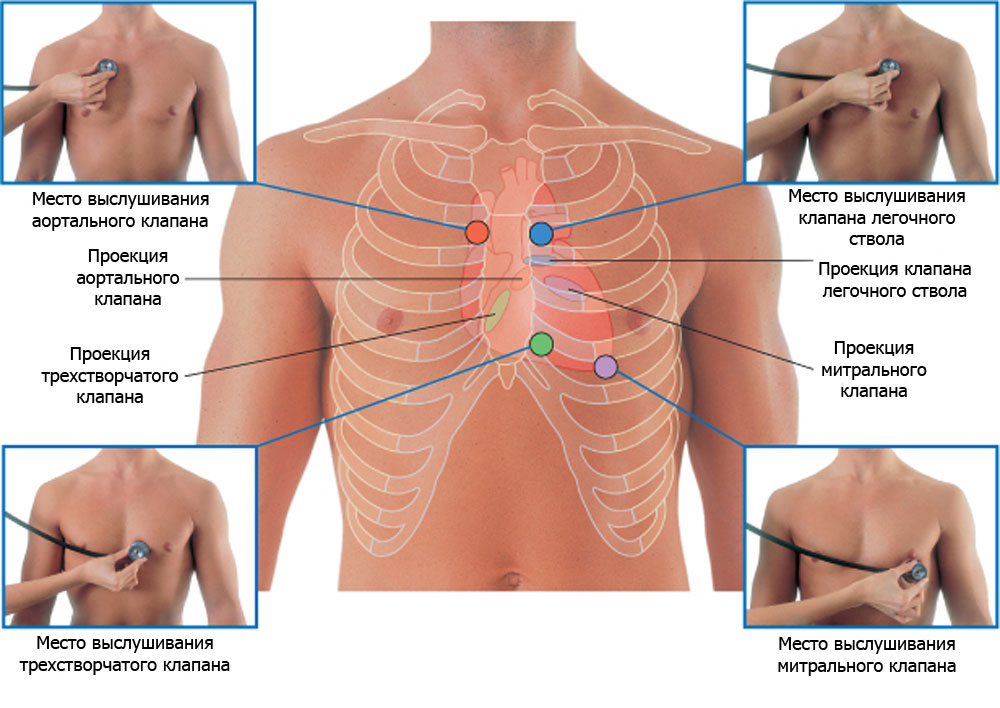 шумы в сердце