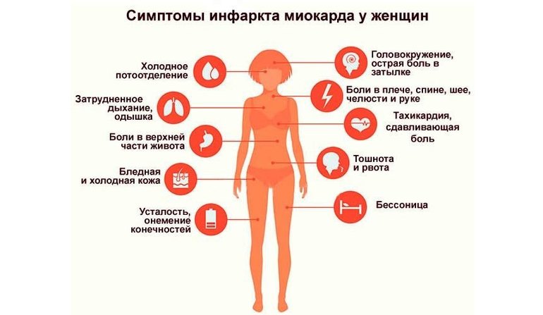 Симптомы инфаркта у женщин