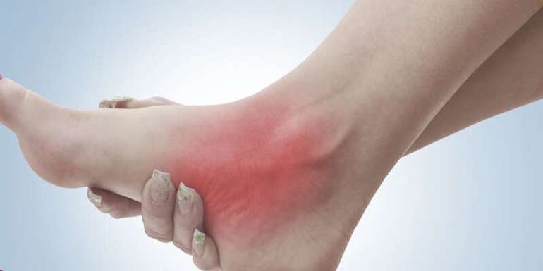 Симптомы полинейропатии