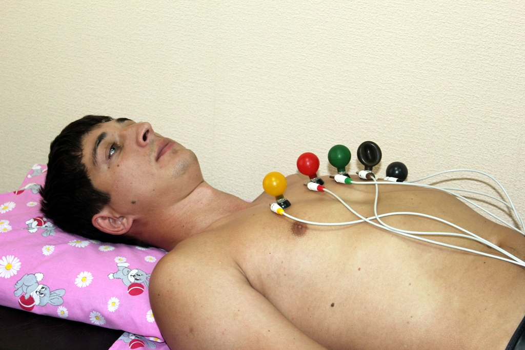 синдром бругада