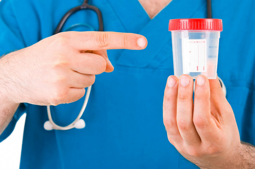 Как правильно собрать суточную мочу