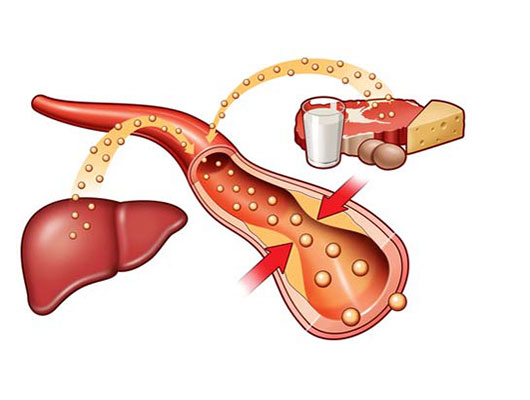 снизить холестерин