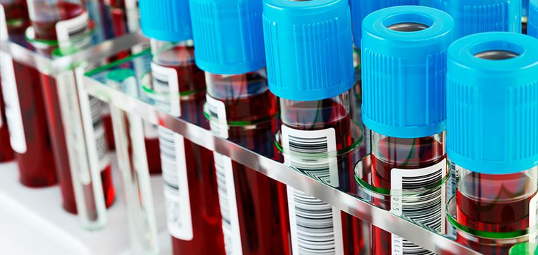 Соэ при онкологии кишечника