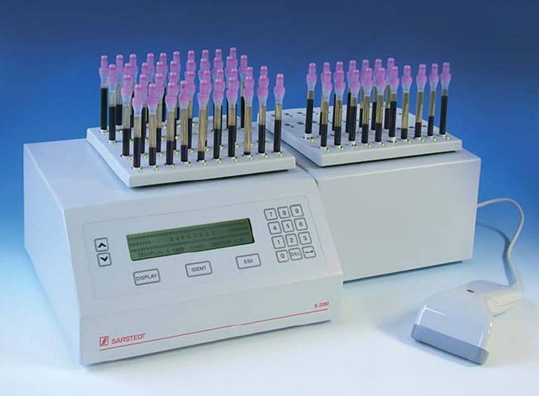 Соэ по вестергрену анализы