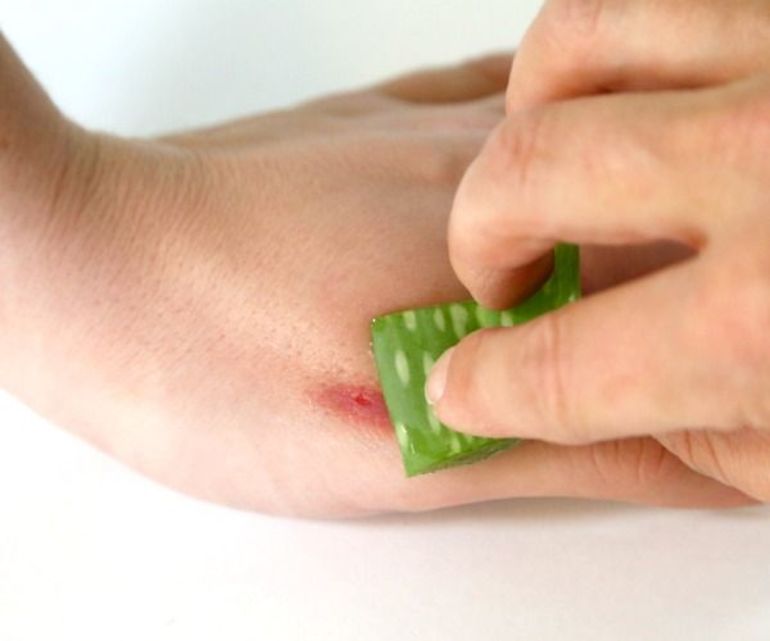 Сок алоэ при ране