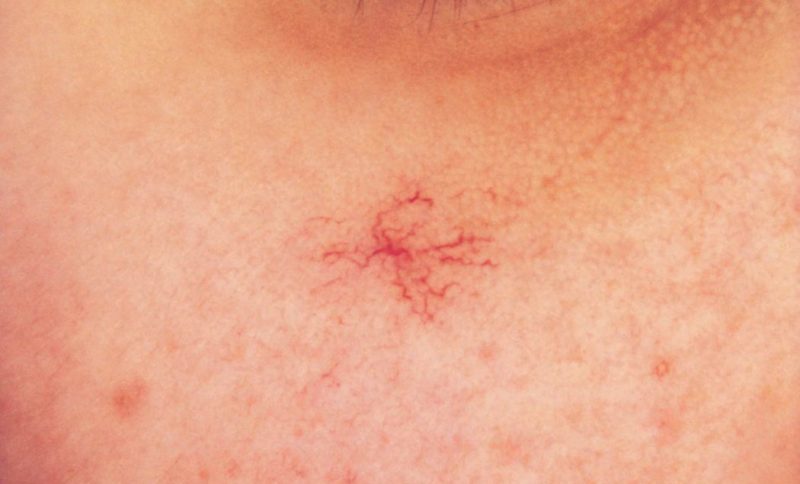 звездочка из сосудов