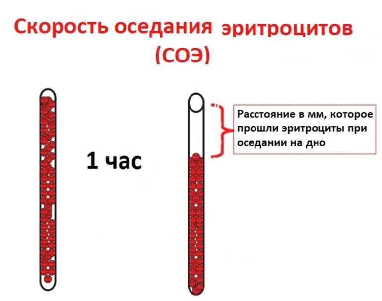 Современные тестирования соэ