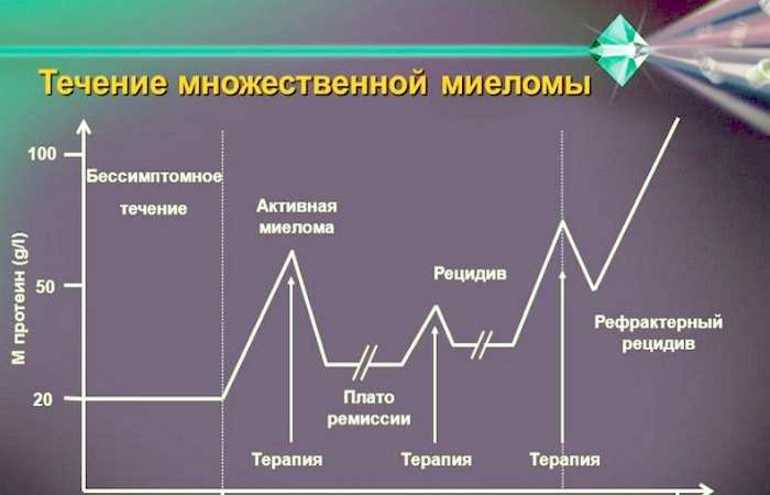 Стадии заболевания