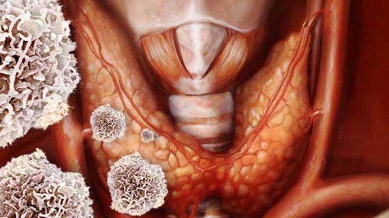 Сущность и значение АТ ТПО