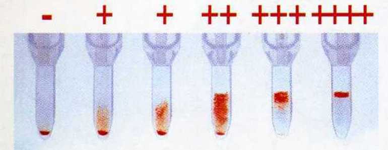 Свертываемость крови