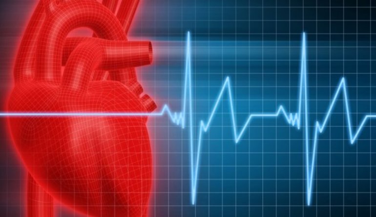 Тахикардия