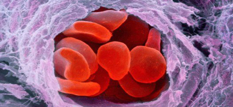 Что такое гемоглобин в крови