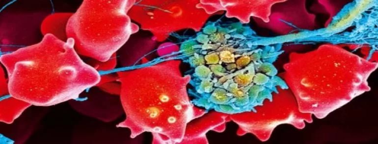 Что такое волчаночный коагулянт