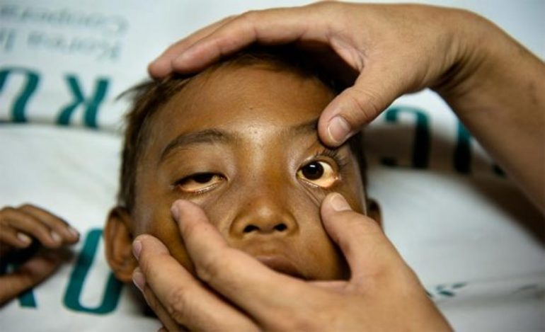 Талассемия признаки