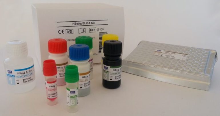 Тимоловая проба повышена причины