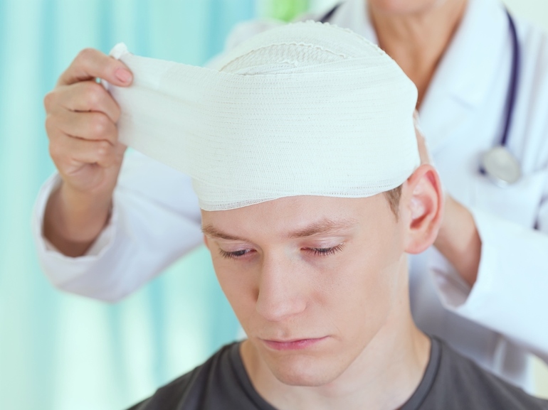 Травма головы