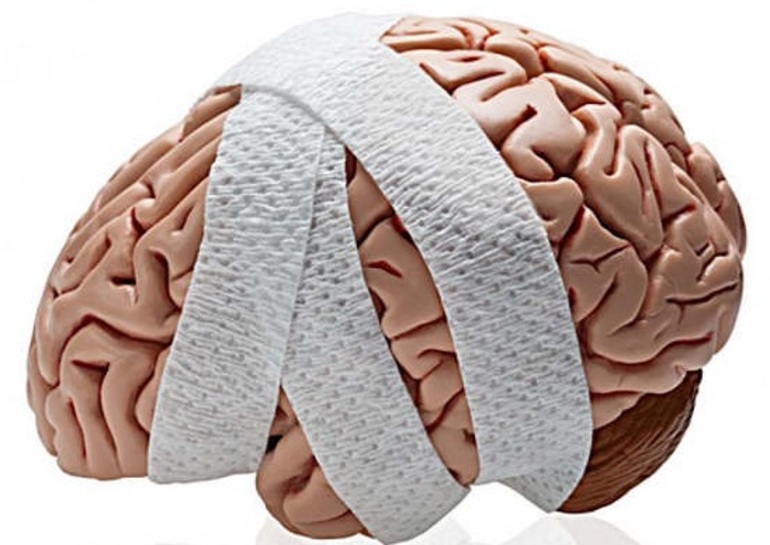 Травмы мозга