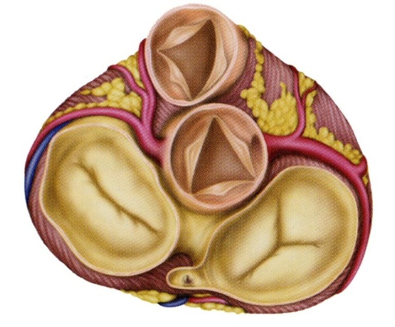 Трехстворчатый клапан