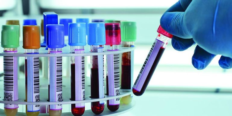 Тромбиновое время.