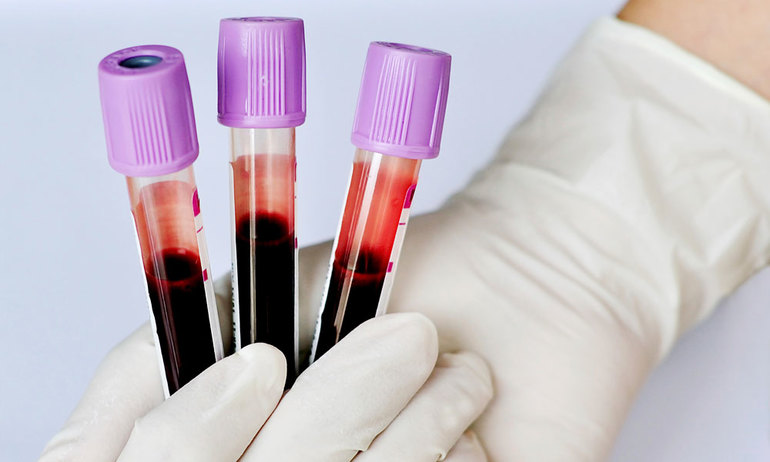 Уровень лейкоцитов в крови