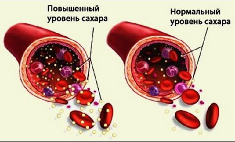 Уровень сахара в крови