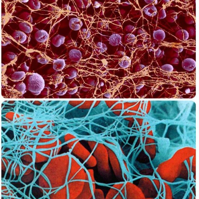 Уровень тромбоцитов в крови