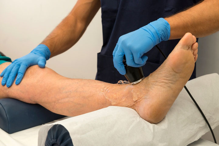 уздг сосудов