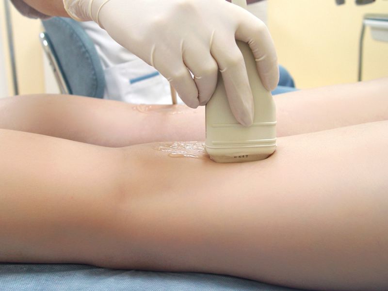 уздг сосудов