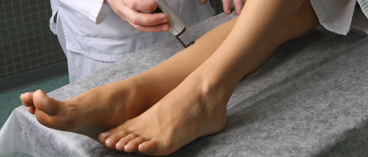 венозная недостаточность