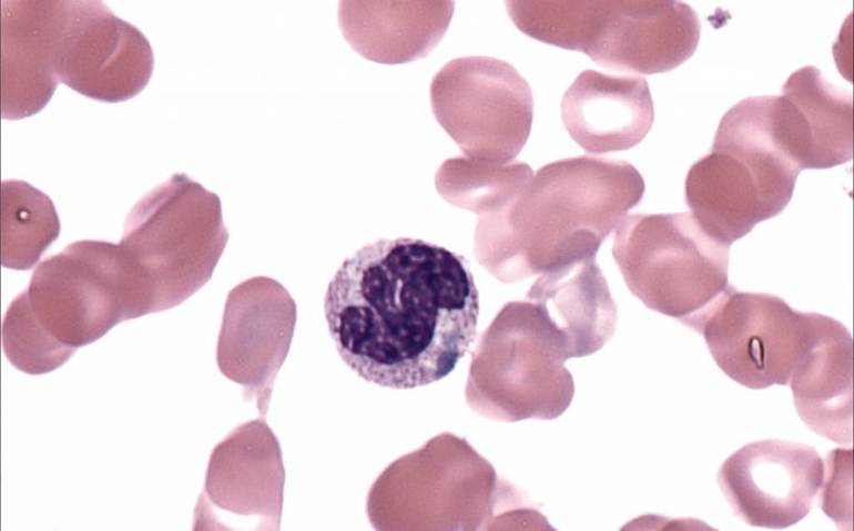 Виды и норма нейтрофилов