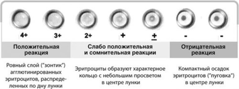 Виды заболевания