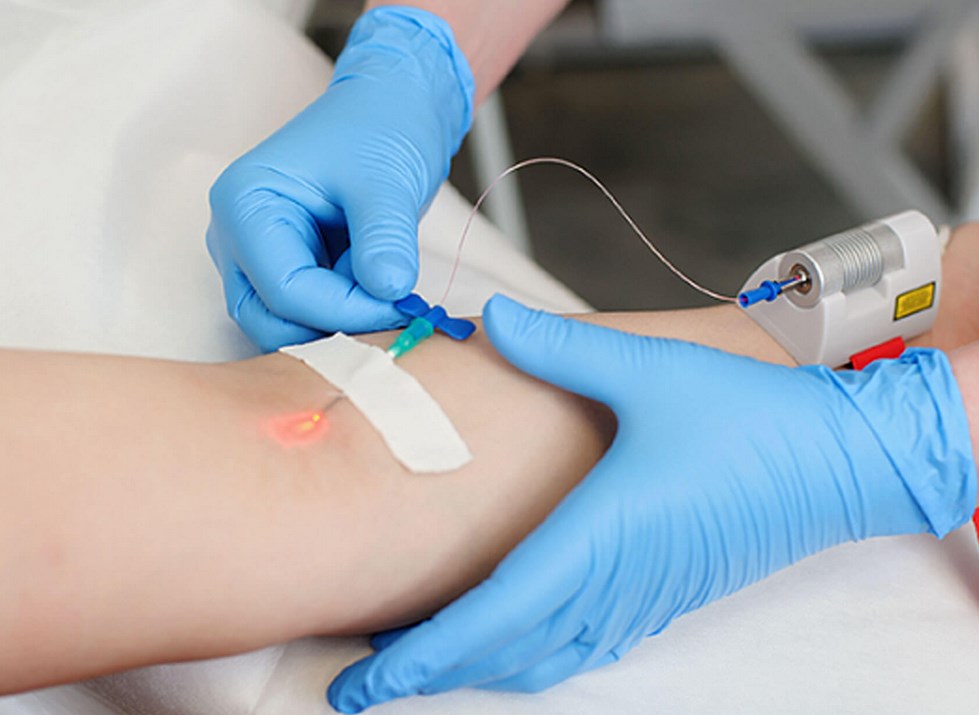 Лазерное облучение крови