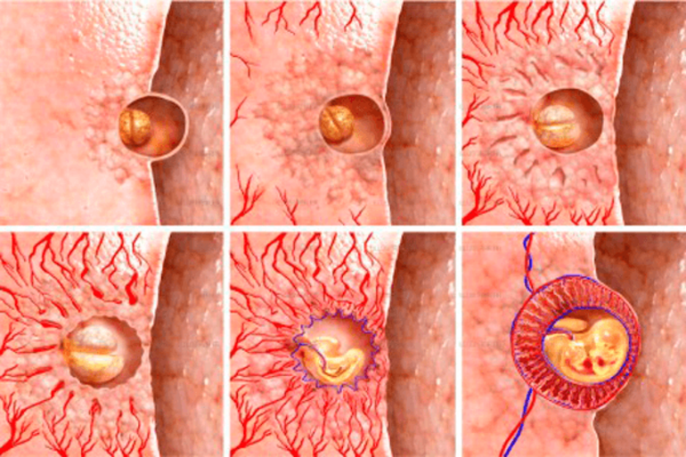 Внедрение плодного яйца в слизистую матки