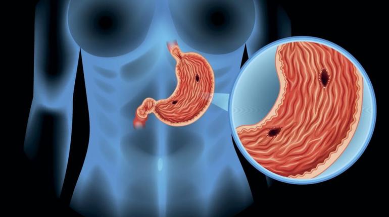 Возможные причины боли в грудине